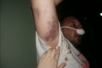 "Жорстко приняли": активісти повідомили про жорстоке побиття поліцією добровольців АТО – фото, відео