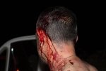 Одеського журналіста троє у балаклавах побили залізними битками