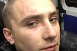 В Одесі екс-лідер "Правого сектора" заявив про напад