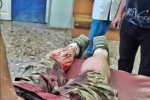 У Києві група невідомих у масках із ножем напала на "кіборга" – опубліковано відео
