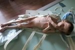 Важить, як піврічне маля: на Кіровоградщині батьки морили голодом трирічного сина – сюжет