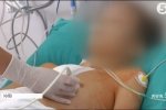 У Києві провели надскладну операцію на серці 13-річному хлопцю: як нині почувається пацієнт