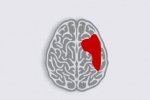 Мозок – це час: Супрун пояснила, чому життєво важливо якнайшвидше надати допомогу людині при інсульті