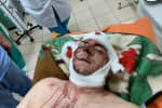 На Сумщині невідомі побили ексочільника Конотопа Семеніхіна