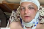 Нападение на экс-главу Конотопа: Семенихин обвиняет в организации нападения на него одного из нардепов