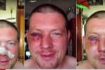 "Це дикий злочин": як водії жорстоко побили пішохода, що зробив їм зауваження – сюжет