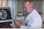 Повністю зруйнована ліва півкуля мозку: лікарі розповіли про стан тяжкопораненого армійця