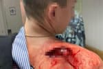 Пьяный полицейский избил и выстрелил в охранника в Днепре – подробности