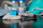 За минулу добу в Україні зафіксували 23 229 нових випадків COVID-19