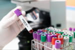 В Киеве резкий скачок госпитализированных с COVID-19