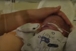 День "торопыжек": львовские медики показали, как борются за жизнь преждевременно рожденных детей