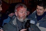 Стало відомо, скільки нападів на журналістів та активістів зафіксували в Україні від початку року