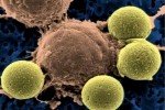 Стоп рак: Онкологи кажуть про вдале випробування вакцини у боротьбі з меланомою