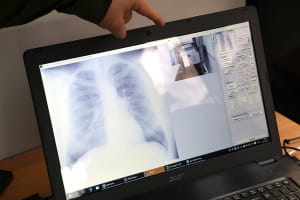 Рентгенмобіль для НГУ