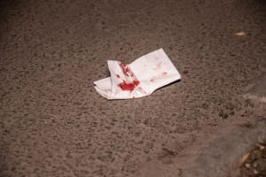 У Києві чоловіку прострелили око