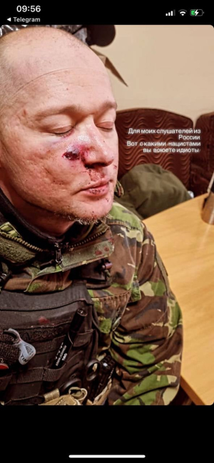 Андрей Хливнюк попал под минометный обстрел