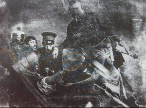 Это первая фотография ампутации была сделана 18 апреля 1847 во время американо-мексиканской войны. На ней изображен сержант Антонио Бустос с бельгийским хирургом Педро Вандером Линденом, который гордо позирует с оторванной ногой в руке.