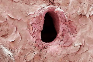 Вот как выглядит дыра в коже после того, как ее прокалывает игла