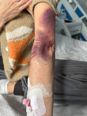 Хвороба та лікування