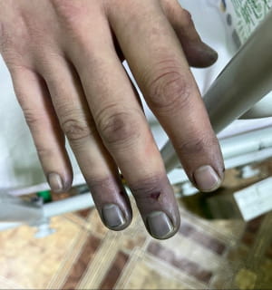 Задержаны уклонисты с обмороженными ногами и руками