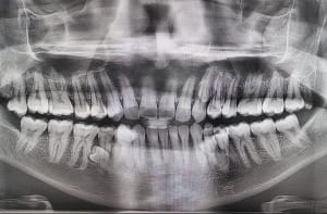 Пратаб Муніанді