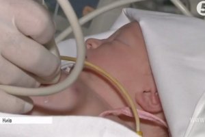 "Золоті скальпелі": як у Києві проводять надскладні операції на маленькому серці