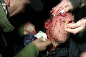 "Беркут" жорстоко побив Юрія Луценка