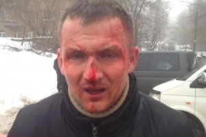 У Києві жорстоко побили нардепа-"свободівця"