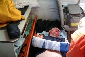 На Полтавщині невідомі сильно потовкли прибічника Саакашвілі