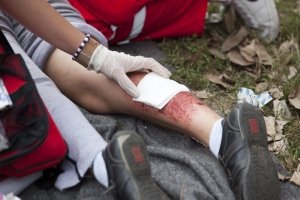 Базова аптечка на випадок НС: Супрун розповіла, чим укомплектувати набір