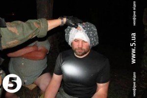 Бійці "Кривбасу" взяли в полон двох терористів на Донеччині, один з них виявився співробітником МВС - ЗМІ