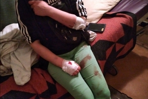У балаклавах, з металевими прутами та ножами: у Львові напали на анархістів