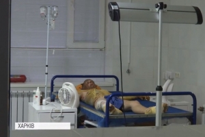 Юний герой потребує вашої допомоги: 16-річний хлопець обпік 60% тіла, рятуючи дідуся