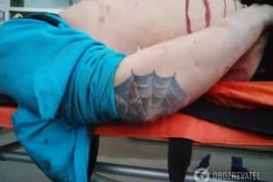 Посеред Києва сталася стрілянина через квартирну суперечку: є жертва