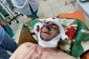 На Сумщині невідомі побили ексочільника Конотопа Семеніхіна