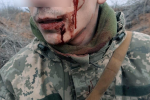 Солдату, який затримав російського бойовика і сам був поранений, вручать державну нагороду