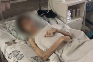 "Лікували духовно": в Одесі батько морив голодом сина-підлітка – з'явилися моторошні подробиці