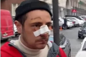 "Був весь у крові": у Києві напали на xлопця, утім поліція закрила справу – подробиці інциденту