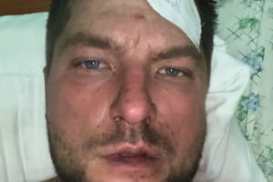 "Я 300-й, но мы не пропустили их" – Александр Погребиский получил контузию