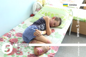 Маленький Микола, який підірвався на снаряді в Донецькій області, потребує допомоги