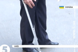 Українські біотехнологи змогли врятувати від ампутації кінцівок 35 бійців
