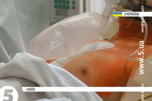Українські кардіохірурги вчаться міняти серцевий клапан без розрізу грудини