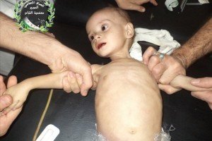 У Сирії люди помирають від голоду