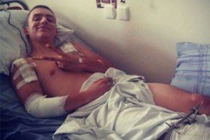 Пораненим бійцям АТО – добровольцю та артилеристу – потрібна допомога, щоб знову могти ходити