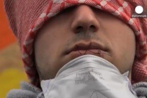 Біженці вигадали новий спосіб протесту проти знесення табору в Кале - зашили собі роти