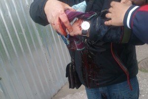 Акція проросійських активістів на Куликовому полі в Одесі закінчилася вибухом петарди