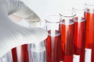 Супрун анонсувала початок трансформації системи крові в Україні