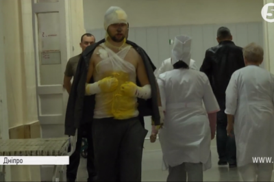 Боєць АТО отримав опіки