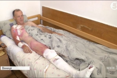 Поранений боєць АТО