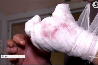 необережне поводження з піротехнікою